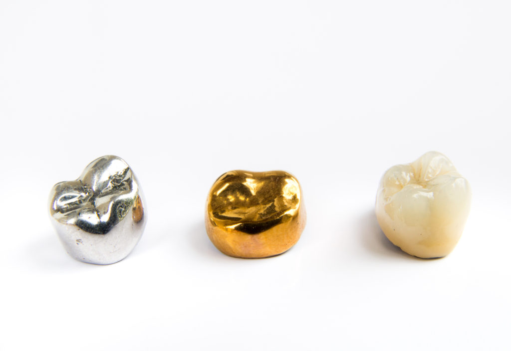 Ceramic, gold and metal tooth crowns used in general dentistry